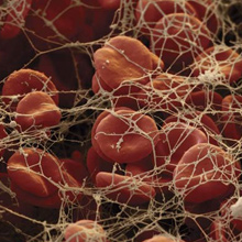 Human blood cfd simulation