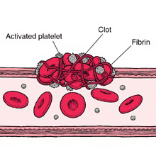 Simulation of blood flow